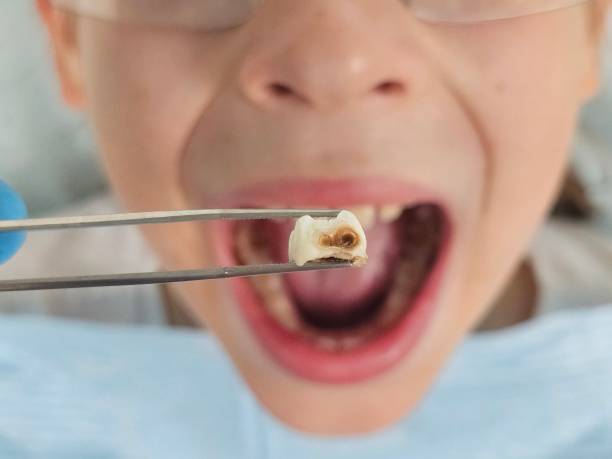 Best Same-Day Emergency Dental Services in Ardmore, AL